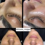 مژگان اسکین کرMojgan skincare