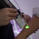 مرکز لیزر ،پوست و زیبایی کندی بیوتی