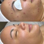 پاکسازی پوست و مو مهسام