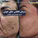 کلینیک پوست مو و لیزر دکتر مهدی سبکتکین