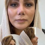 کلینیک زیبایی اویسا پوست،مو،زیبایی  لیزر