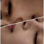 فیشیال / خدمات پوست / سالن زیبایی