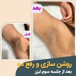 مرکز لیزر روز دنیا