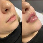 کلینیک پوست و زیبایی ژیلاوَش