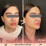 مرکز پزشکی و زیبایی میروژ سنتر