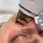 کلینیک لیزر و لاغری مبینا