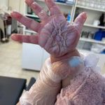 دکتر فرامرز بیرقدار(کلینیک زخم و سوختگی)