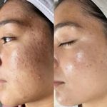 خدمات فیشیال و پاکسازی بانو طالبی