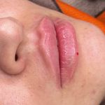 کلینیک پوست مو زیبایی و لیزر هیما