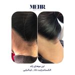 کلینیک زیبایی مهر