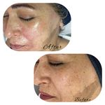 خدمات تخصصی فیشال سارا اسکین بار