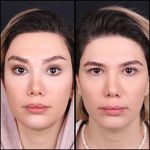 دکتر بهروز جلالی (جراحی بینی لیفت صورت)