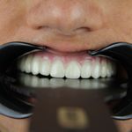 کلینیک دندانپزشکی الف