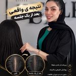اولین مرکز اسکراپ و میکرواسکالپ در مشهد