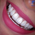 دندانپزشکی پرتو صادقیه از دم قسط با بیمه