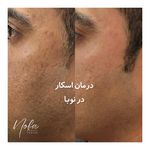 کلینیک زیبایی و لیزر مو زائد نوبا