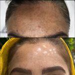 خدمات پوست و مو ( فیشیال)
