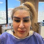 کلینیک زیبایی الینا رز
