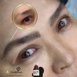 مرکز فیبروز سعیده غارسی