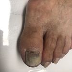 کلینیک درمان زخم و پودولوژی پودا