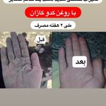 فروش محصولات گیاهی و درمانی نیوشا