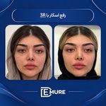 مرکز تخصصی زیبایی و جوانسازی دمور
