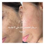 کلینیک زیبایی و لیزر مو زائد نوبا