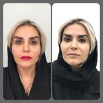 کلینیک لیزر و زیبایی مهرُنا