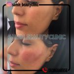 کلینیک پوست مو زیبایی و لیزر ثمین