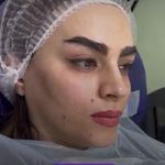 کلینیک زیبایی الماس کاملا اقساطی