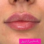 کلینیک زیبایی شایلی