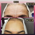 مطب پوست ،مو و لیزر یسنا طب