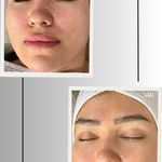 خدمات تخصصی فیشال و پاکسازی پوست صبا