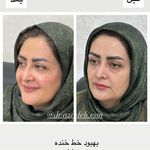 کلینیک زیبایی و لیزر دکتر آزاده اسماعیلی