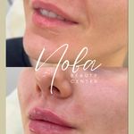 کلینیک زیبایی و لیزر مو زائد نوبا