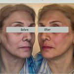 کلینیک پوست مو زیبایی زیما