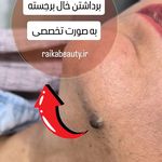 کلینیک زیبایی رایکا