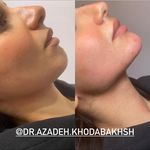 مطب زیبایی آرا