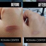 کلینیک پوست مو و زیبایی رکسانا