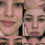 فیشیال / خدمات پوست / سالن زیبایی