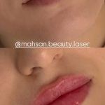 کلینیک لیزر و زیبایی مهسان