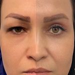 کلینیک پوست وزیبایی ومرکز تخصصی فیلربادی