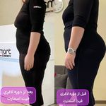 مرکز لاغری موضعی و ایکس بادی فیت اسمارت