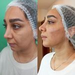 کلینیک زیبایی پارسیان آلفا