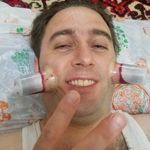 حجامت تخصصی کل بدن اکبرکریمی سیار(منزل)