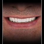 دکتر کیارش مهدی پور جراحی لثه و ایمپلنت