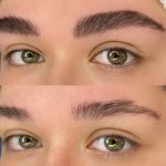 مرکز تخصصی فیبروز ابرو مژگان خناری