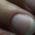 ناخنکار مهنیا