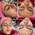 کلبه پوست لاوین