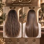 خدمات تخصصی احیا مو سایه علیزاده